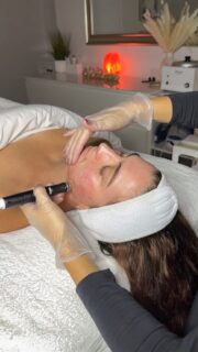 Hydrafacial is one of the most powerful, non-invasive skin resurfacing treatments available today. It combines cleansing, exfoliation, extraction, hydration and antioxidant protection that removes dead skin cells and impurities, while simultaneously delivering moisturizing serums into the skin 💆‍♀️
 
Book your hydrofacial appointment today! 📩
www.themmskin.com

#hydrofacial #chicagobuccalmassage #chicagofacial #chicagolaserhairremoval