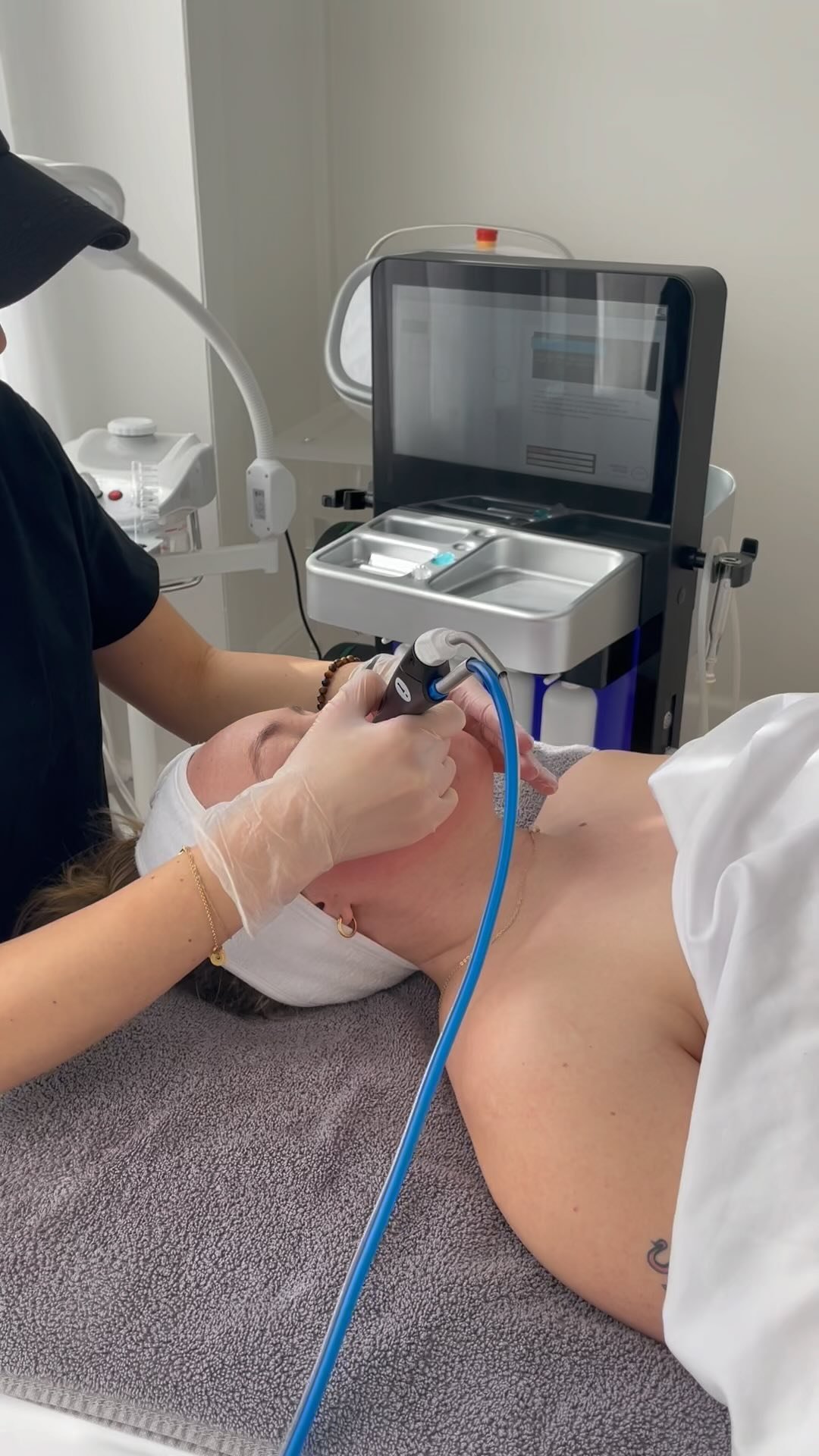 Hydrafacial is amazing when it comes to facials. It does a multitude of things in one treatment. Deep pore cleanse, chemical exfoliation, physical exfoliation, extracts, improves texture, deeply hydrates, and infuses serums. With a variety of serums and steps in the treatment you leave the treatment room with radiant, healthy and glowy looking skin!
Have you tried a Hydrafacial yet?