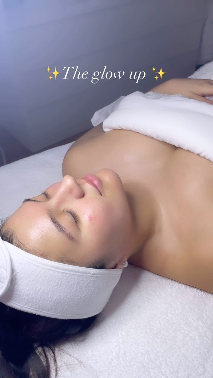 ✨The Glow Up ✨ Facial ✨
🩵What’s included? 🩵
•Double cleanse
•Lymphatic drainage
•Hydrofacial(exfoliation, extraction, serum infusions)
•Sheet Mask
•Neck + Décolleté massage
•Cold Globe face massage
•Finishing products(drops, serums, oil and mist, moisturizer)
•
•
•
If you haven’t tried this treatment you’re missing out.
Book yours today! Booking link in bio! Treatment name Hydrofacial The glow up!
If you have questions feel free to DM!
#chicagospa #westloopskincare #westloopchicago #westloopesthetician