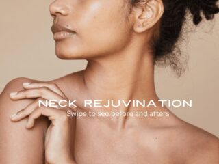 Neck Glow Up- Just Wow 🌟💫✨
Thank you to my amazing client who agreed to have her results posted because wow! 
It’s as if we took 10 year off the neck. We achieved these results with ONLY 3 microneedling sessions! If you ever doubted the amazing results of microneedling here is your proof that it is in fact an amazing treatment(not only for loss of elasticity, but scarring, pigmentation, texture and loss of collagen).

If you are interested in this treatment and have questions feel free to message me or book your appointment today! Booking link in bio! 

#chicagoskin #chicagiomicroneedling #westloopspa #westloopsalon #chicagoesthetician #yourestiebestie #westloop #westloopchicago