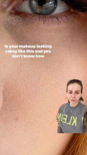 Hope this Helps 🪄
#yourskinwitch #estibestie #skincaretips