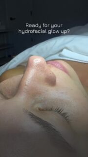 Come experience the DIFFERENCE for yourself…
#chicagoskincare #chicagofacials #chicagoesthetician #bestfacialchicago